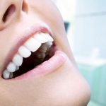 Glutaredox teeth whitening info that you had to find out