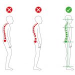 Afflictions of Your Back That Can Cause poor Posture
